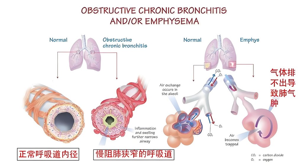 respiratory health respiratory health